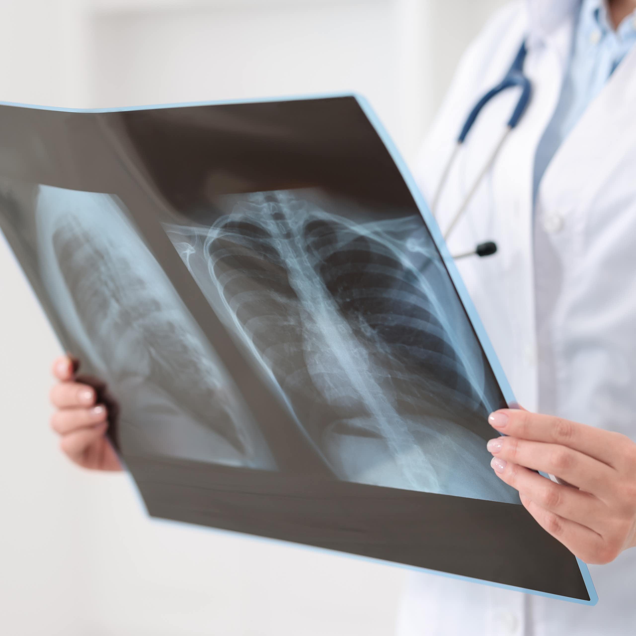 Médico olhando uma radiografia pulmonar